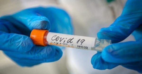2485 нови случая на заразяване с коронавирус са регистрирани у