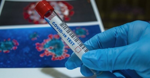 1004 нови случая на коронавирус са регистрирани у нас през