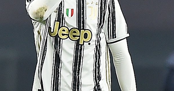 Цитомегаловирусът род от херпесните вируси може да причини варицела и