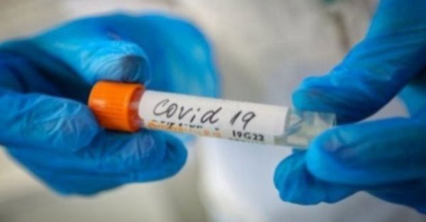 2806 са новите диагностицирани с коронавирус през изминалите 24 часа