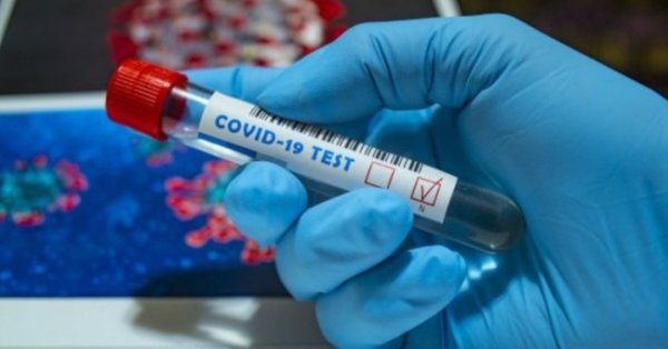 3869 са новите случаи на заразени с коронавирус при направени