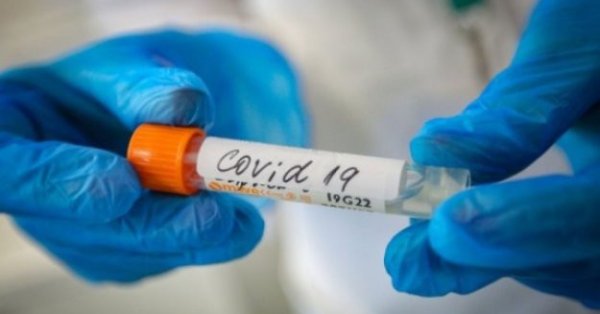 1246 са регистрираните нови заразени с коронавирус през последното денонощие
