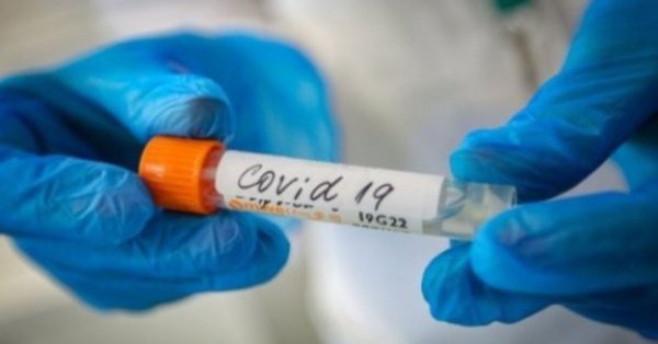 621 са регистрираните нови заразени с коронавирус през последното денонощие